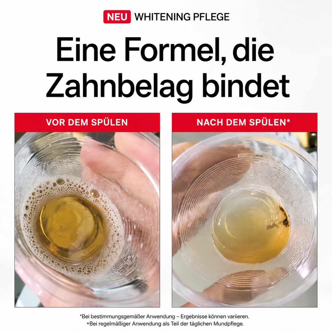 UPERA iD Stain Whitening Mundspülung