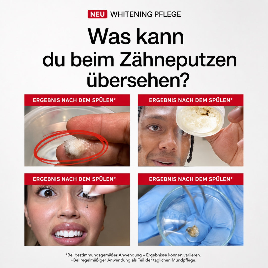 UPERA iD Stain Whitening Mundspülung