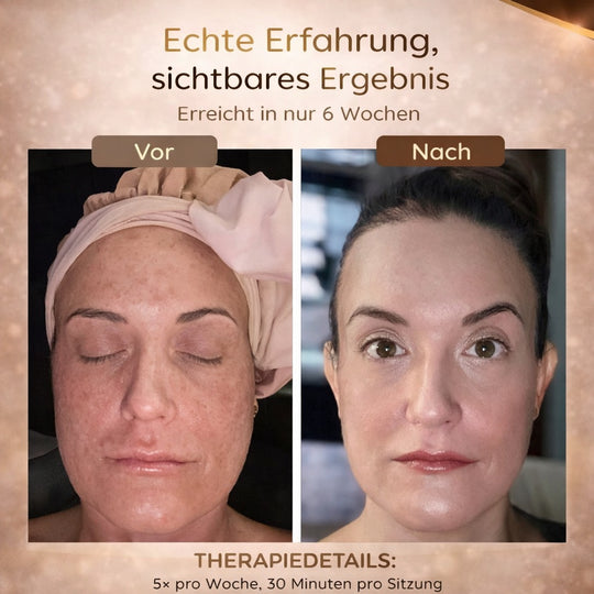DermaLight LED Gesichtsmaske
